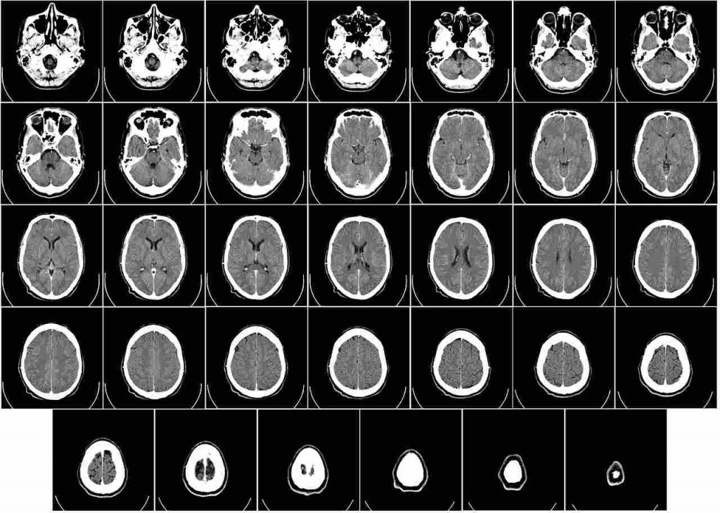 Radiografia