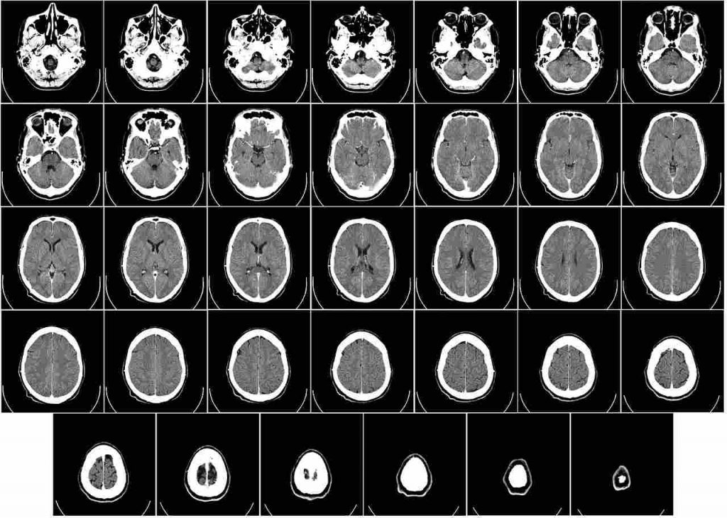 Radiografia