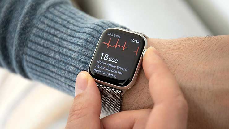 Apple Watch problemi watchOS 8.4 app Wallet